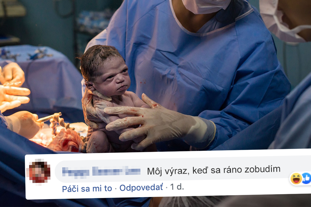 Toto dieťa sa narodilo pre meme. Jeho výraz spustil vlnu zábavných komentárov