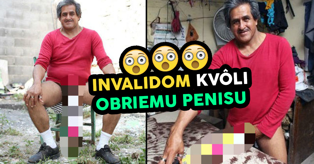 Mexičan získal vďaka svojmu obriemu pohlavnému orgánu status invalida