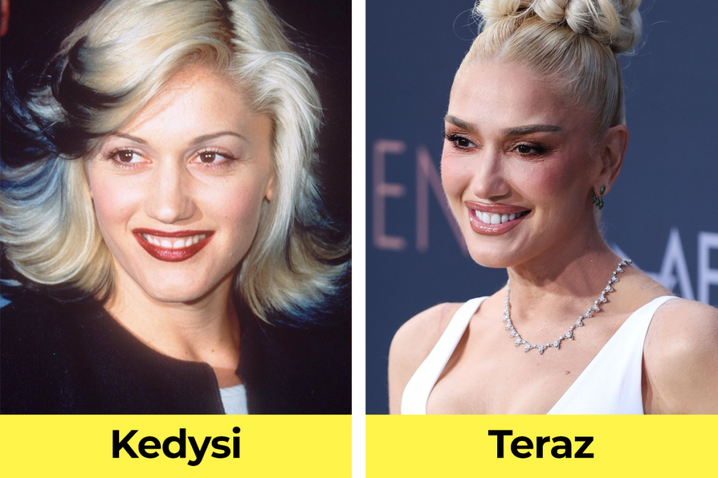 Gwen Stefani na začiatku kariéry vs. teraz