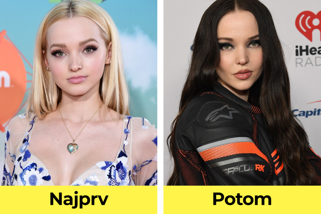 celebrity, známe osobnosti, plastická operácia, pred verzus po plastickej operácii, Dove Cameron