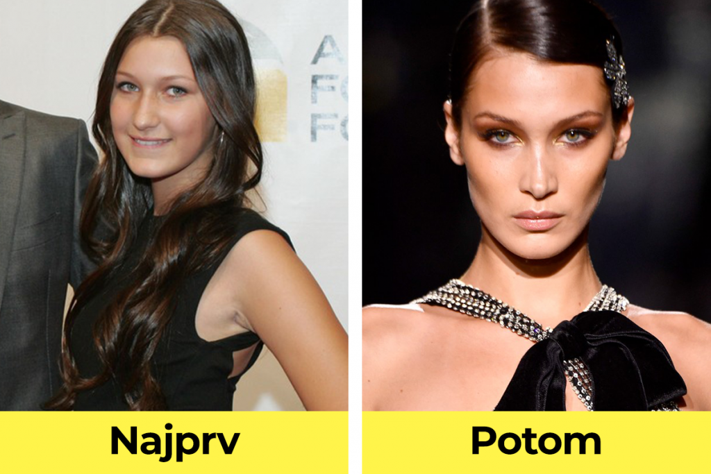 celebrity, známe osobnosti, plastická operácia, pred verzus po plastickej operácii, Bella Hadid