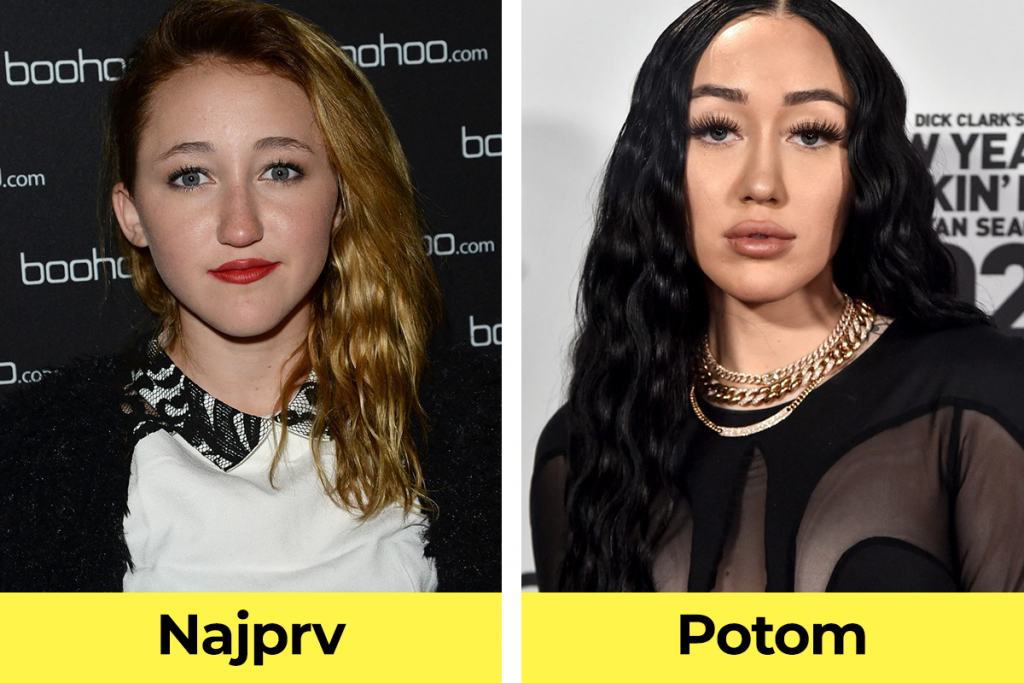 celebrity, známe osobnosti, plastická operácia, pred verzus po plastickej operácii, Noah Cyrus