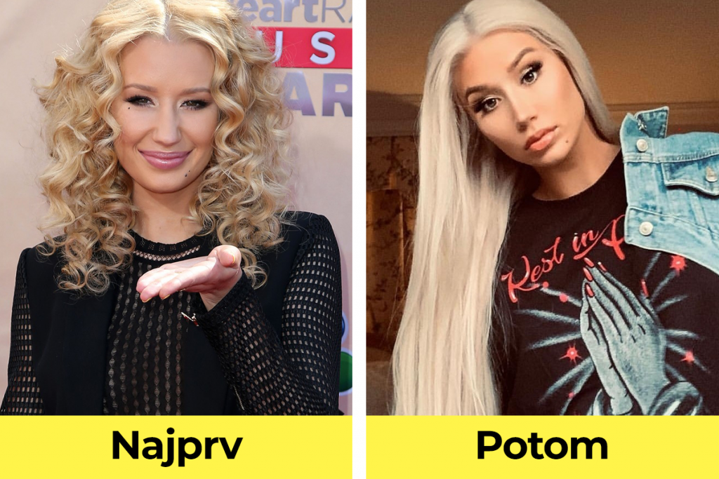 celebrity, známe osobnosti, plastická operácia, pred verzus po plastickej operácii, Iggy Azalea