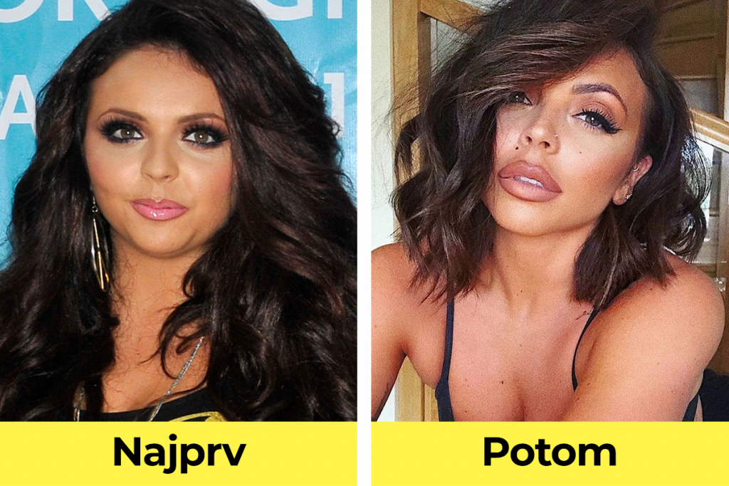 celebrity, známe osobnosti, plastická operácia, pred verzus po plastickej operácii, Jesy Nelson