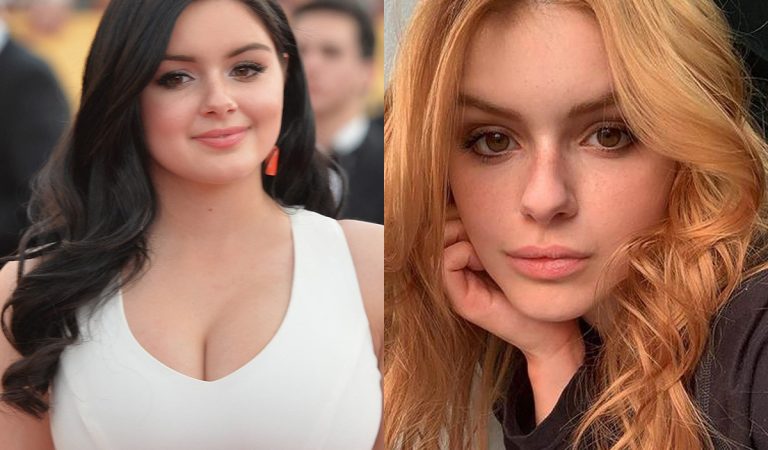celebrity, známe osobnosti, plastická operácia, pred verzus po plastickej operácii