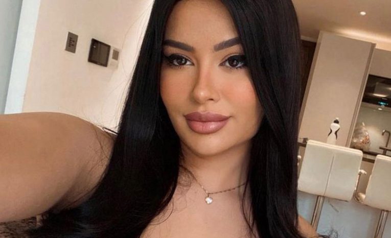 Na plastiky minula už 18-tisíc. Modelka z OnlyFans sa chce podobať na Kylie Jenner