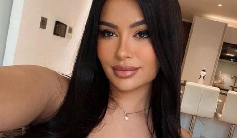 Na plastiky minula už 18-tisíc. Modelka z OnlyFans sa chce podobať na Kylie Jenner