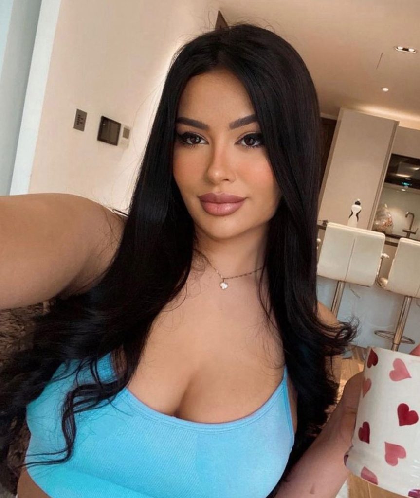 Julia Medeiros, Kylie Jenner, plastická operácia, OnlyFans