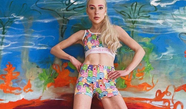 Modelka si dala chirurgicky predĺžiť nohy o 14 centimetrov. Dnes to ľutuje