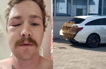 18 ľudí, ktorí majú za sebou vskutku traumatizujúce zážitky s bodavým hmyzom