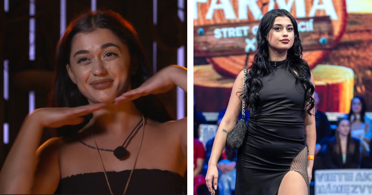 Azra po Farme rozbieha influencerskú kariéru. Podstúpila vylepšenie tváre