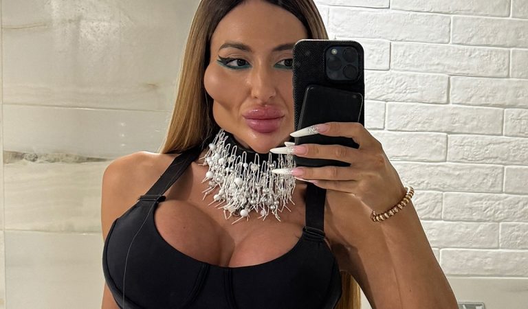 Žena s najväčšími lícnymi kosťami šokovala internet. Týmto zákrokom to už vraj prepískla