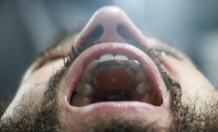 Originálne zariadenie MouthPad umožňuje ovládať počítač jazykom