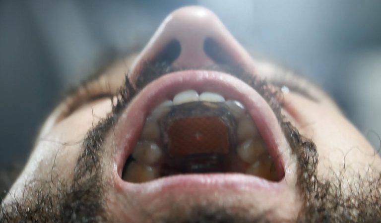 Originálne zariadenie MouthPad umožňuje ovládať počítač jazykom