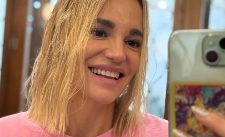 Dara Rolis otvorene o plastikách: Operácia nosa ma trochu zmenila, nechcela som, aby niekto vedel o facelifte