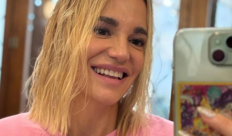 Dara Rolis otvorene o plastikách: Operácia nosa ma trochu zmenila, nechcela som, aby niekto vedel o facelifte