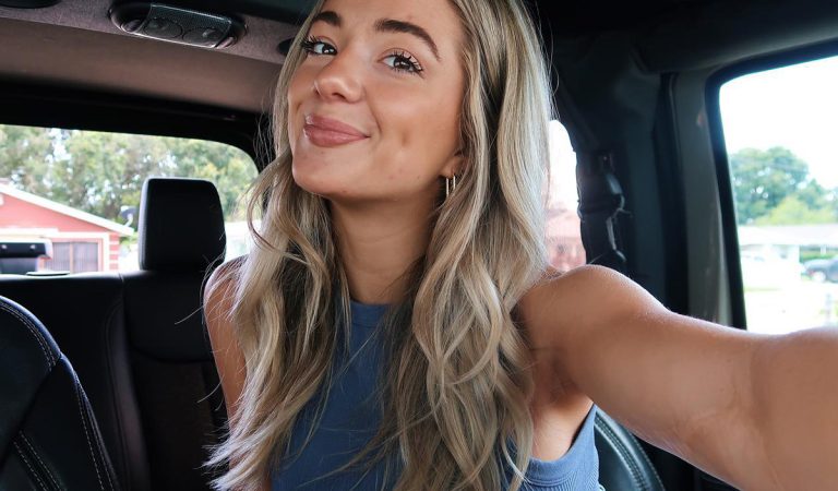 V detstve na ňu zaútočil žralok, dnes je hviezdou OnlyFans. Fanúšikov jej jazva občas desí