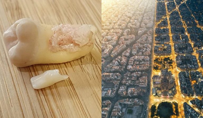 Od zubov až po LEGO počítače. 20 zaujímavých porovnaní, aké si ešte nevidel