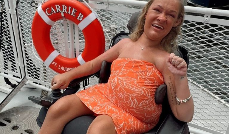 OnlyFans modelka s vzácnym ochorením rozpráva o svojom intímnom živote