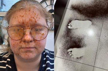 Od jedla až po dvere na sprche. 20 nečakaných explózií, ktoré ľuďom pokazili deň