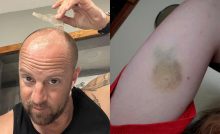 Anomálie a záhady ľudského tela. 20 prípadov, keď si na sebe ľudia všimli niečo nezvyčajné