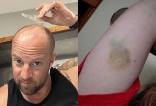 Anomálie a záhady ľudského tela. 20 prípadov, keď si na sebe ľudia všimli niečo nezvyčajné