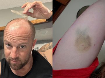 Anomálie a záhady ľudského tela. 20 prípadov, keď si na sebe ľudia všimli niečo nezvyčajné