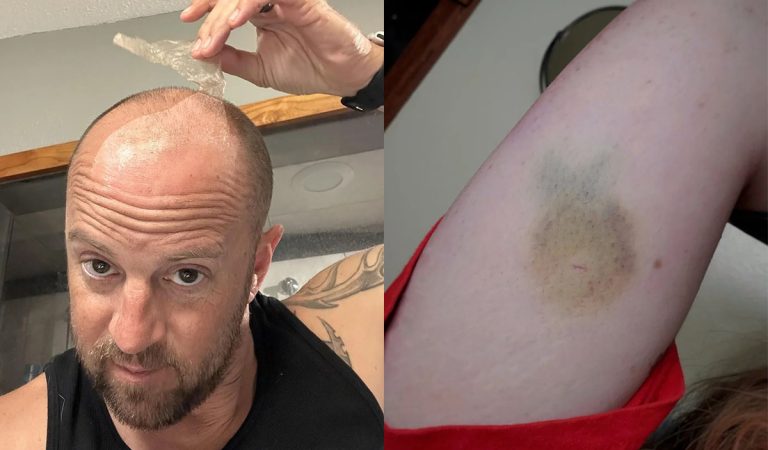 Anomálie a záhady ľudského tela. 20 prípadov, keď si na sebe ľudia všimli niečo nezvyčajné