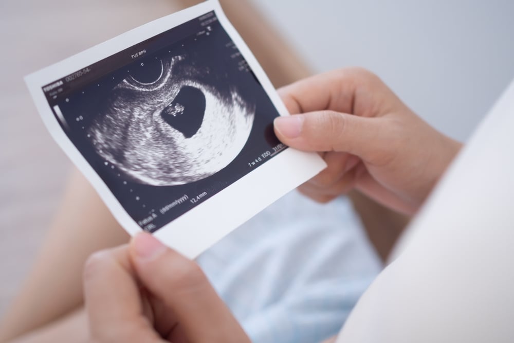 Tajomstvá, ktoré ľudia aj v dospelosti taja pred svojimi rodičmi
