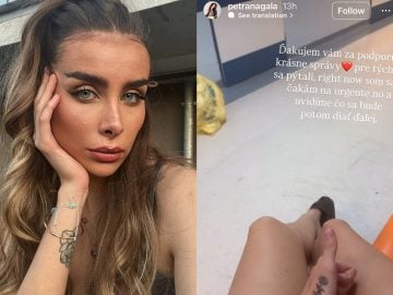 Víťazka Ruže pre nevestu obvinila otca z napadnutia. Na pomoc jej musela prísť polícia
