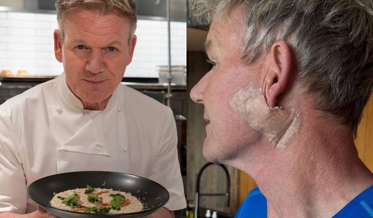Gordon Ramsay karcinóm rakovina