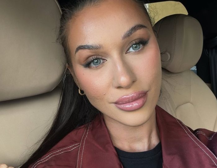Bianka Rumanová prešla ďalším estetickým zákrokom: Toto ľudia vôbec nečakali, nešetria kritikou