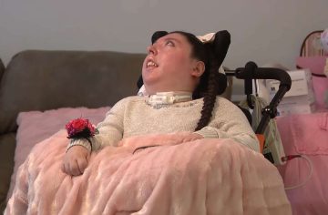 Žena žije už 20 rokov bez funkčného mozgu. Nevidí, nepočuje, no jej rodičia sa nevzdávajú