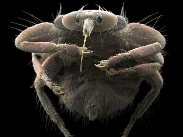 parazity mikroskop kliešť