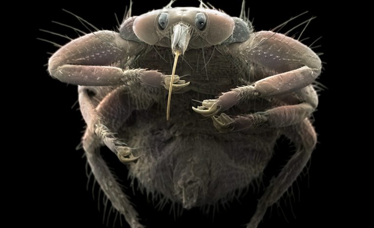 parazity mikroskop kliešť