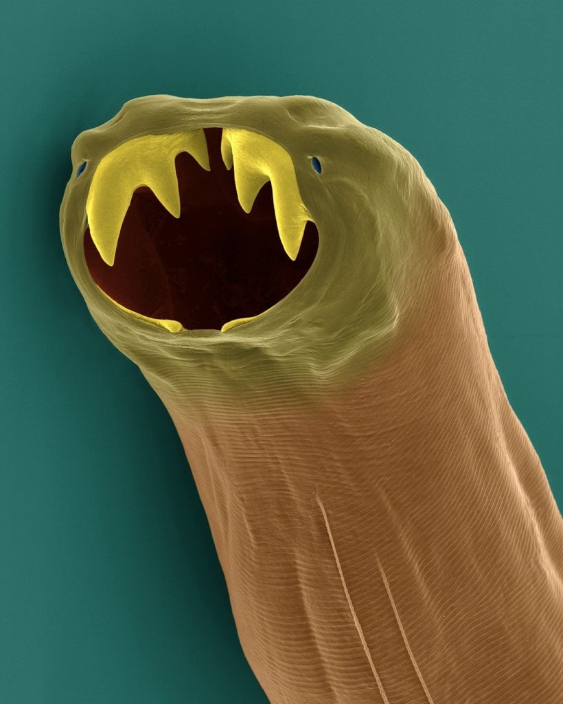 Niektoré sú roztomilé, iné zase poriadne nechutné. Takto vyzerajú ľudské parazity pod mikroskopom
