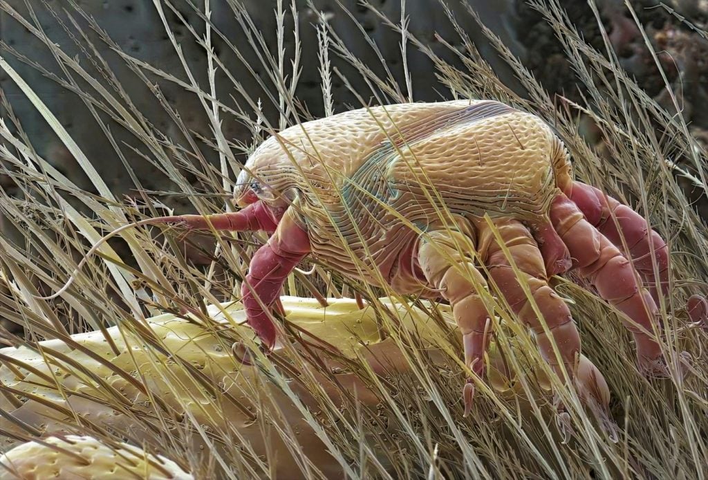 Niektoré sú roztomilé, iné zase poriadne nechutné. Takto vyzerajú ľudské parazity pod mikroskopom