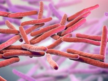 lepra prvé prípady slovensko zahraničie rumunsko chorvátsko choroba nákaza