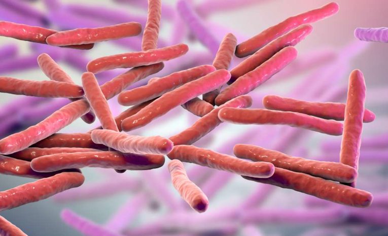 lepra prvé prípady slovensko zahraničie rumunsko chorvátsko choroba nákaza