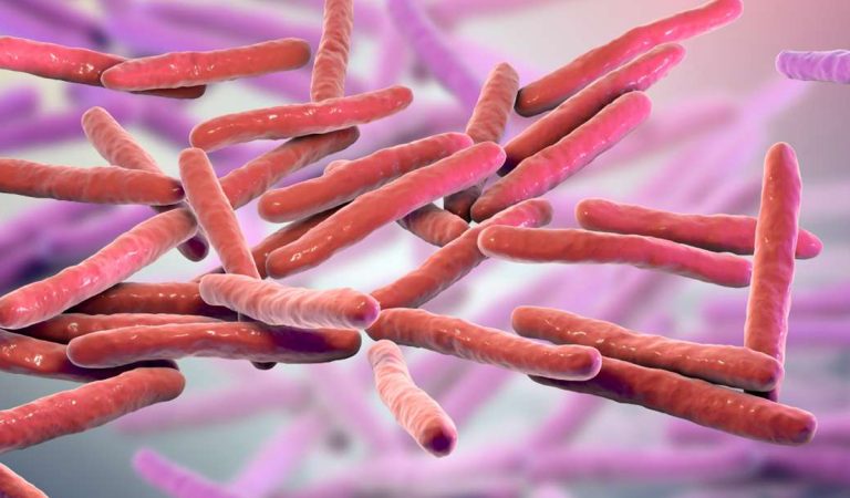 lepra prvé prípady slovensko zahraničie rumunsko chorvátsko choroba nákaza