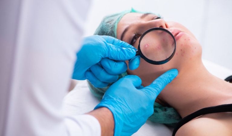 Našiel si si na tvári takúto bodku? Nepodceňuj to a vyhľadaj lekára, môže ísť o vážny problém