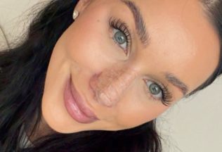 bianka rumanová nový nos kritika fanúšikovia