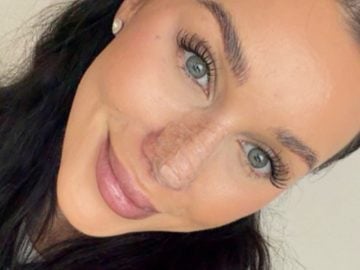 bianka rumanová nový nos kritika fanúšikovia