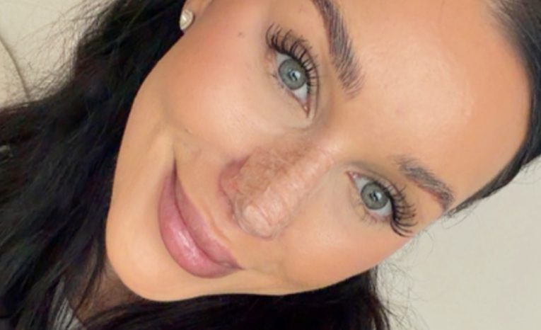 bianka rumanová nový nos kritika fanúšikovia