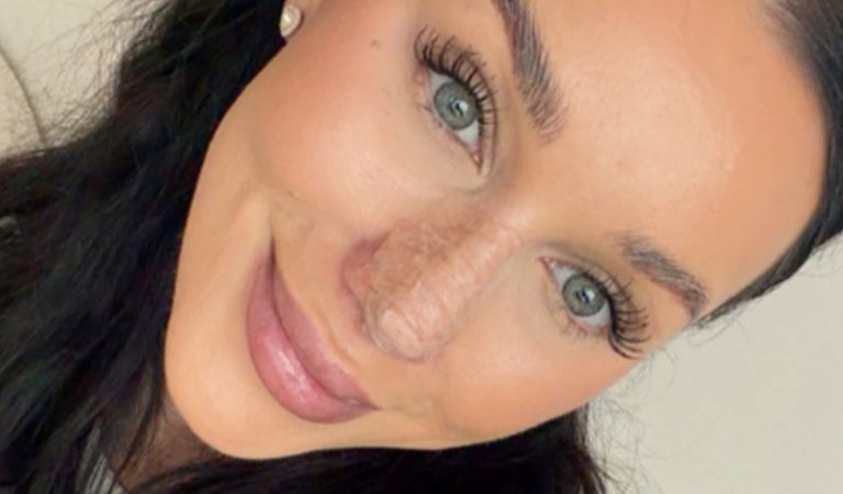 bianka rumanová nový nos kritika fanúšikovia