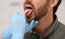 príznaky, rakovina, jazyk, zdravie, veda