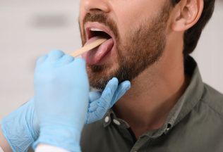 príznaky, rakovina, jazyk, zdravie, veda