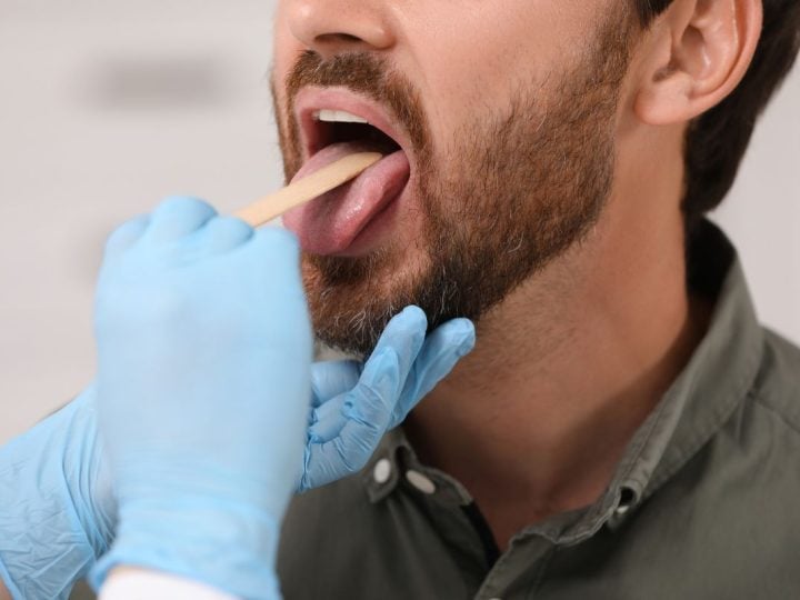 príznaky, rakovina, jazyk, zdravie, veda