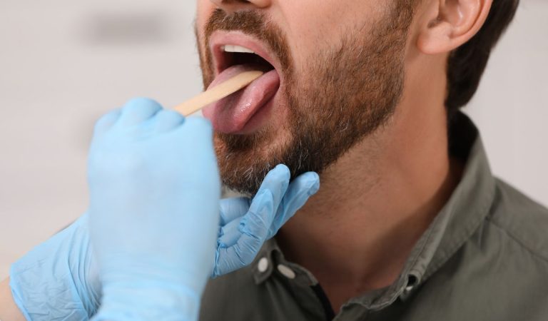 príznaky, rakovina, jazyk, zdravie, veda