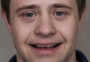 angelmanov syndróm diagnóza ľudia úsmev neustále šťastie
